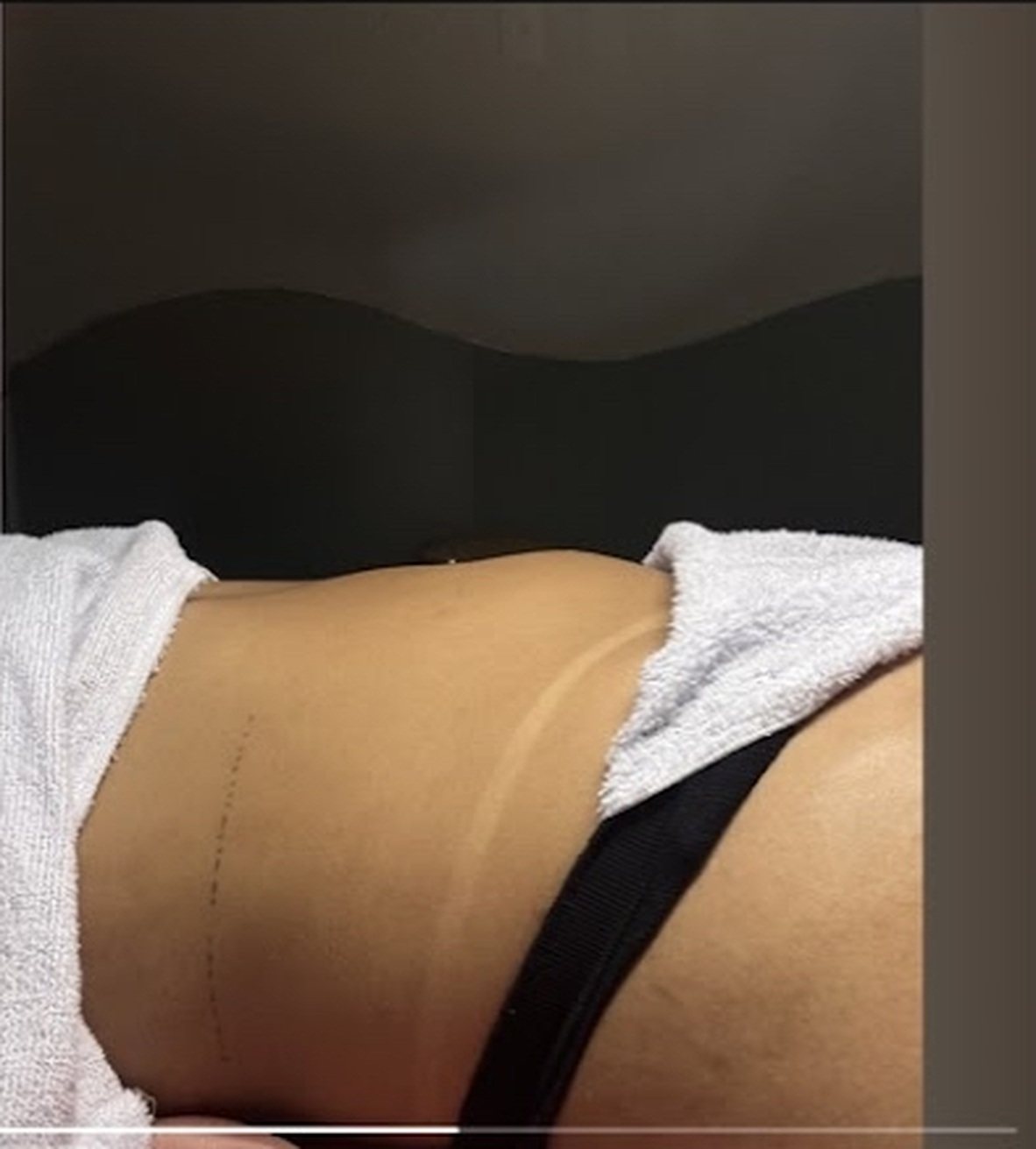 Massagem modeladora